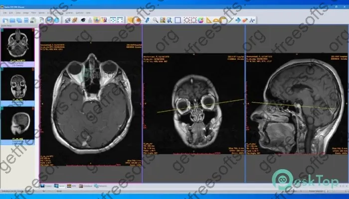 Sante DICOM Viewer Pro Crack 14.0.8 Free Download