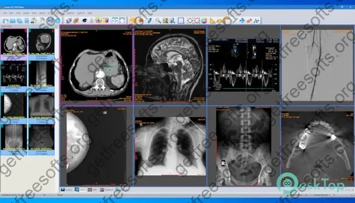 Sante DICOM Editor Crack 10.0.9 Free Download